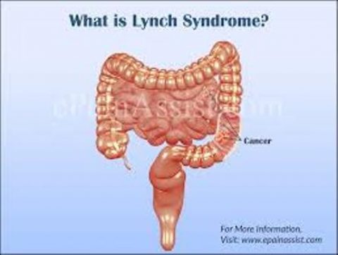 LYNCH SYNDROME